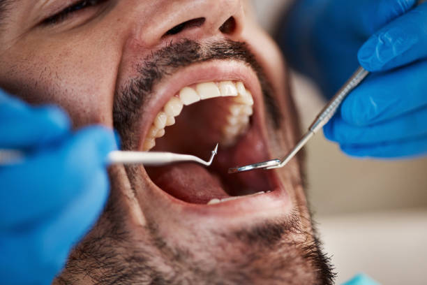 Best 24-Hour Emergency Dentist in Mount Olive, MS